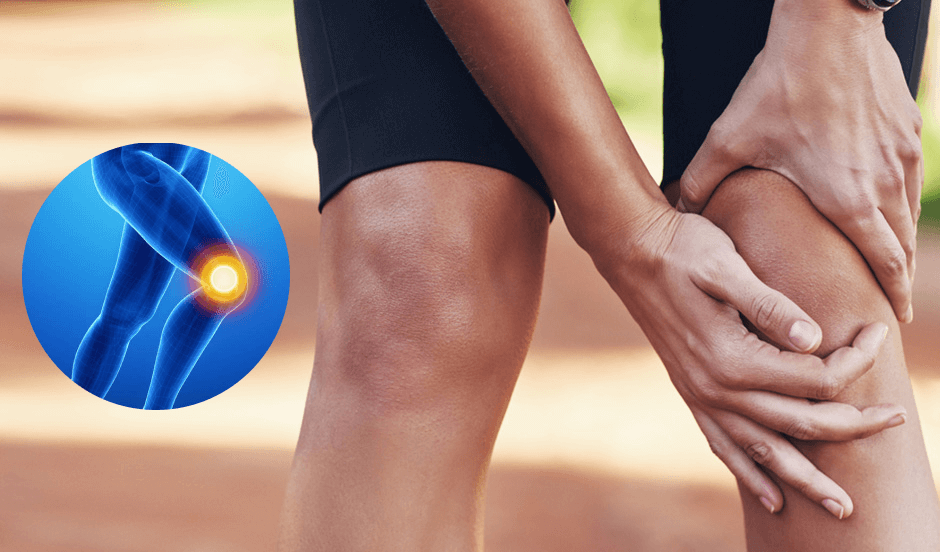 ACL Reconstruction